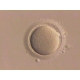 In-Vitro Fertilization Glass Pipettes (IVP1A and IVP1B)
